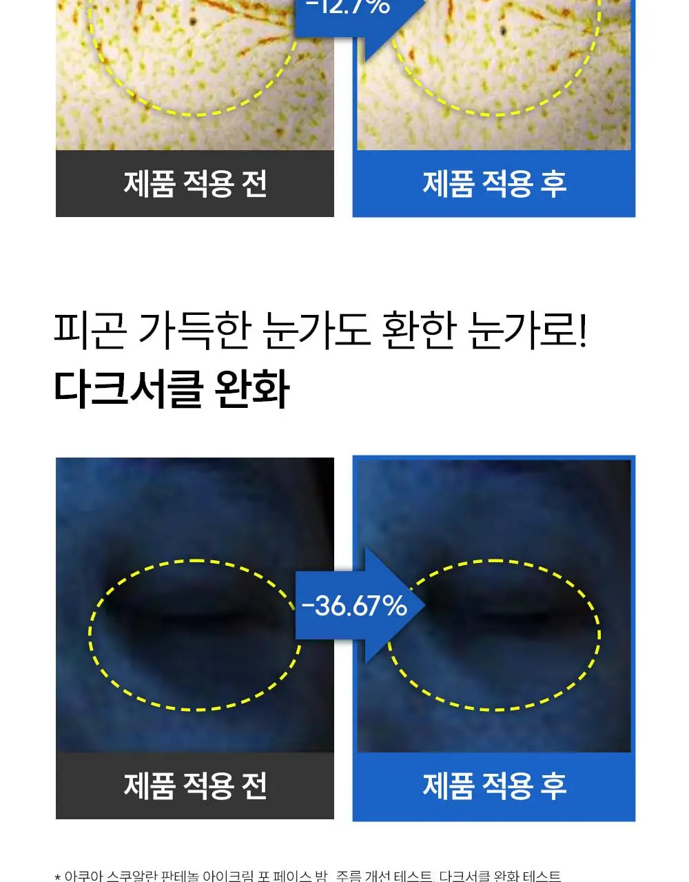[단백질 아이크림] 에스네이처 아쿠아 스쿠알란 판테놀 아이크림 포 페이스 밤 25g 상세페이지 16